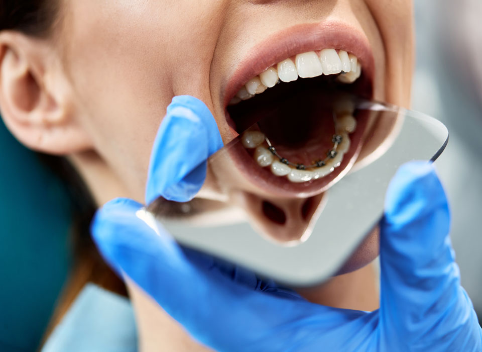 Your Lingual Braces Journey at Cheshire Orthodontics