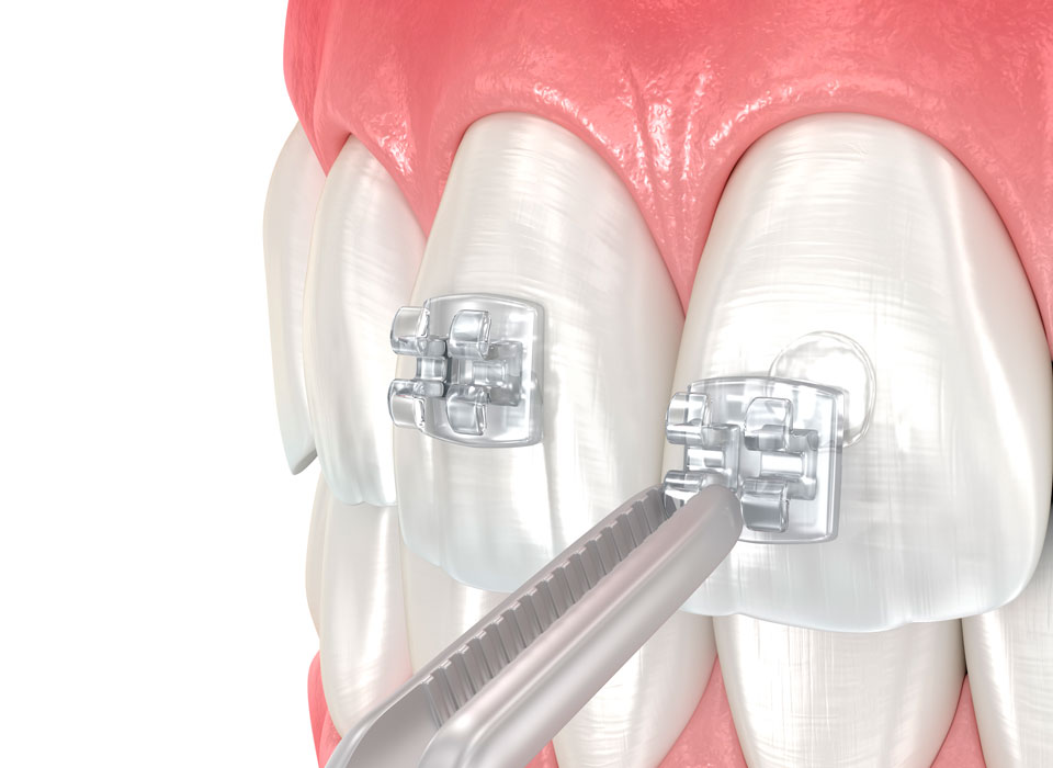 What to Expect During Treatment