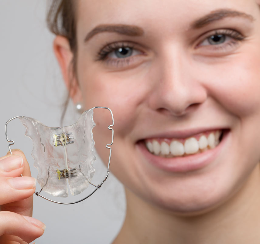 Why Are Retainers Important?